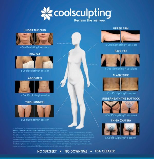 CoolSculpting: Non-Invasive, Targeted Fat Reduction & Contouring